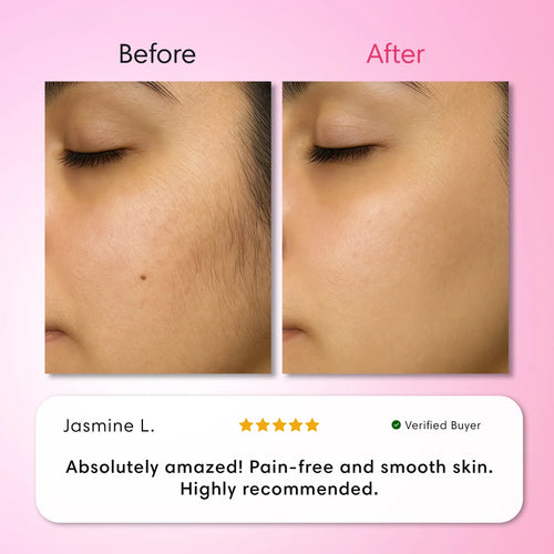 Veloura Hair Removal Trilogy Kit