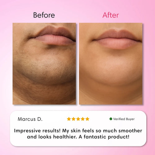 Veloura Hair Removal Trilogy Kit
