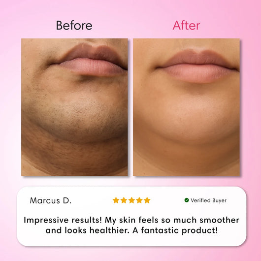 Veloura Hair Removal Trilogy Kit