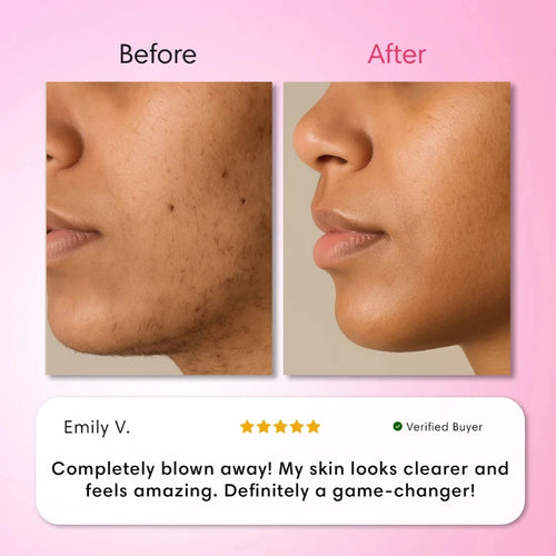Veloura Hair Removal Trilogy Kit