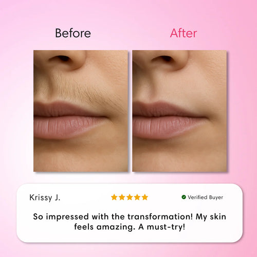 Veloura Hair Removal Trilogy Kit