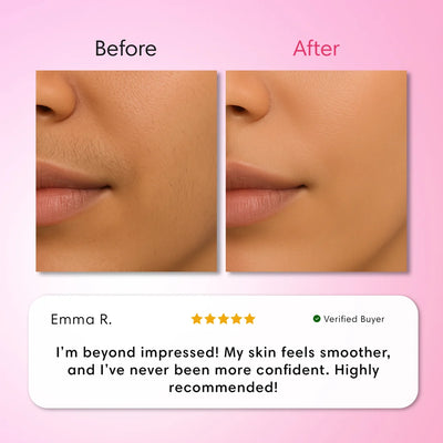 Veloura Hair Removal Trilogy Kit