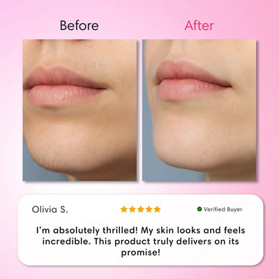 Veloura Hair Removal Trilogy Kit